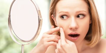 Cea mai buna crema impotriva cosurilor si acneei