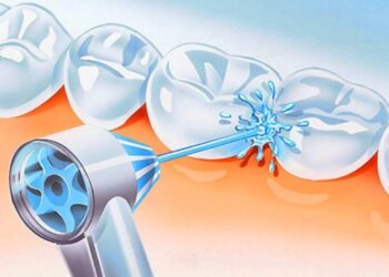 Cel mai bun dus/irigator bucal