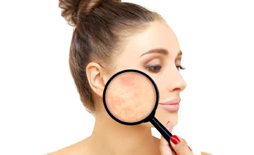 Crema pentru pete pigmentare de calitate